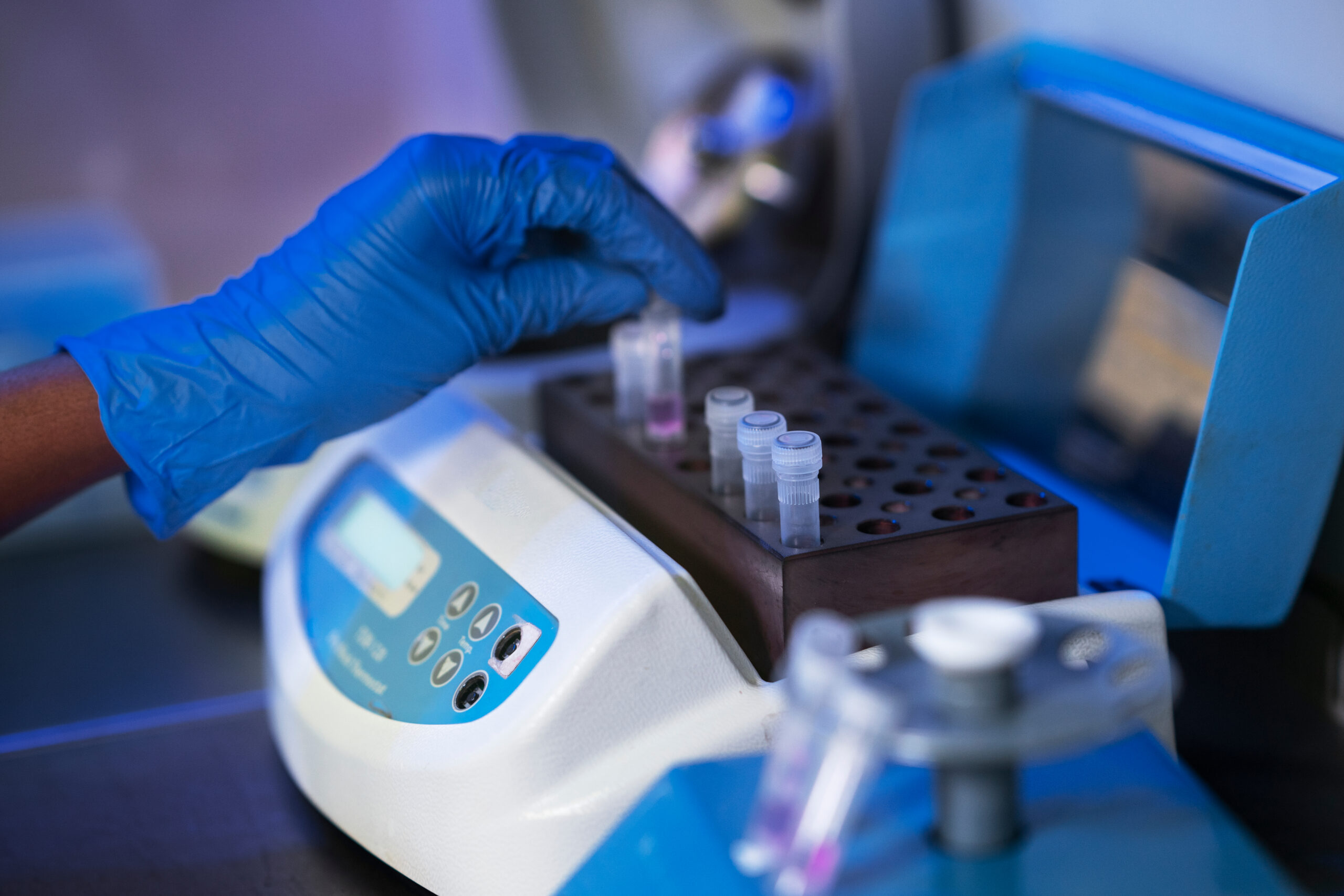 AI-Powered Drug Discovery in Modern Research